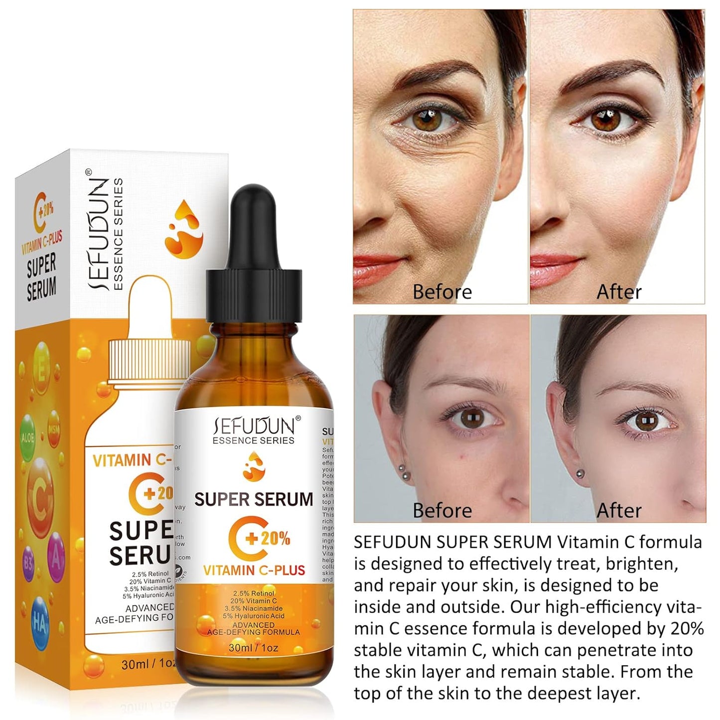 Super Vitamin C Face Serum with Niacinamide, Hyaluronic Acid, Anti Aging Serum