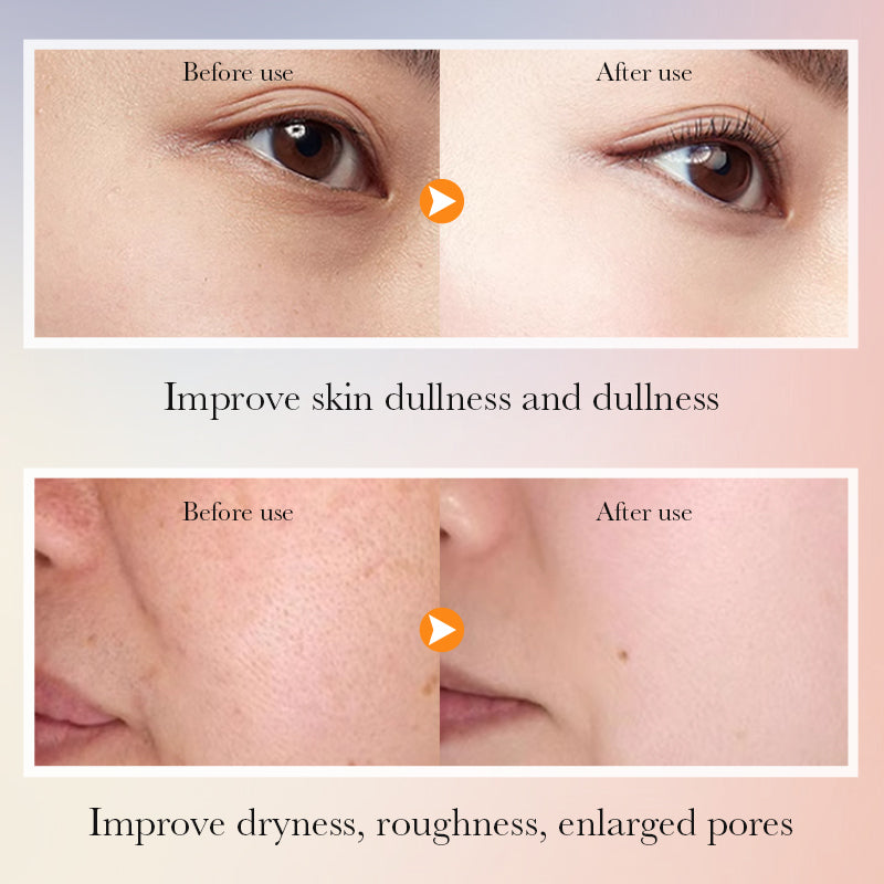 5X VITAMIC C Face Skincare Set – 6 in 1 Complete Anti-Aging Kit