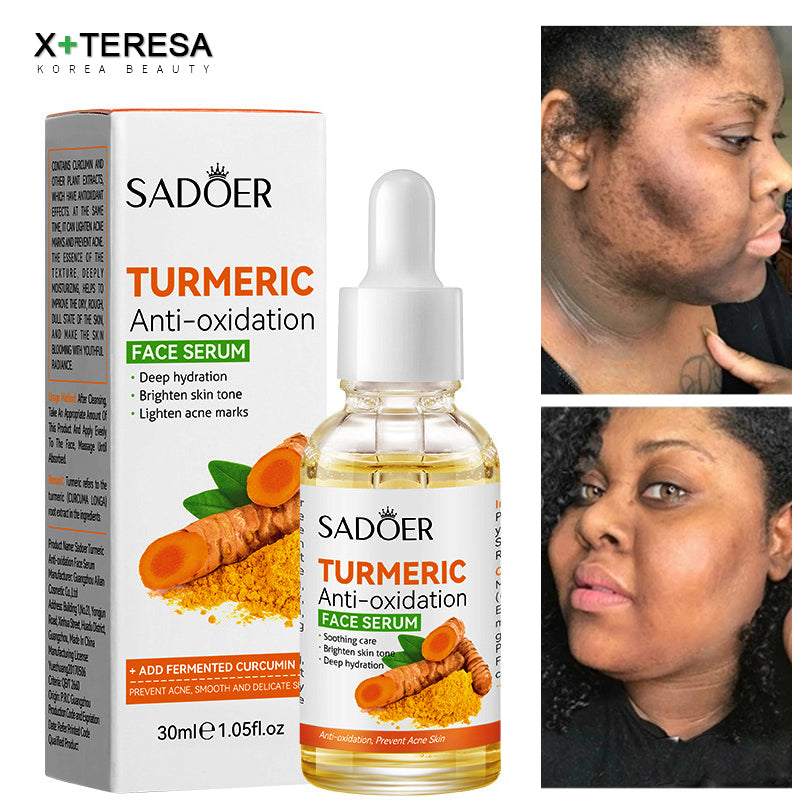 Organic Turmeric Face Serum + FREE SOAP COMBO Antioxidant/ Anti-aging /Hydrating/Anti-Acne/Dark Spots Corrector