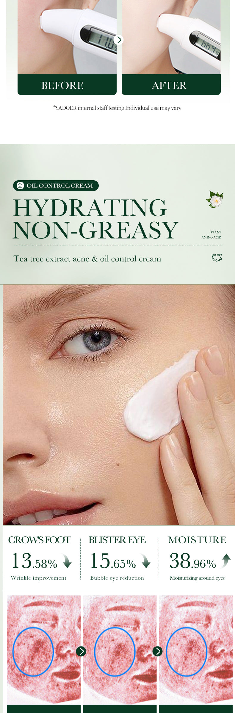 100% Organic Tea Tree Oil Acne Control Face Cream for Smooth Skin Care