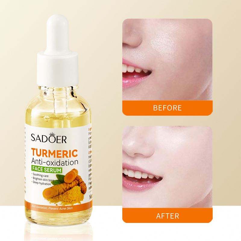Organic Turmeric Face Serum + FREE SOAP COMBO Antioxidant/ Anti-aging /Hydrating/Anti-Acne/Dark Spots Corrector